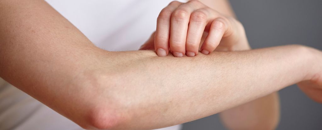 Fungi on Your Skin Could Produce a Potent Antibiotic to Fight Infections