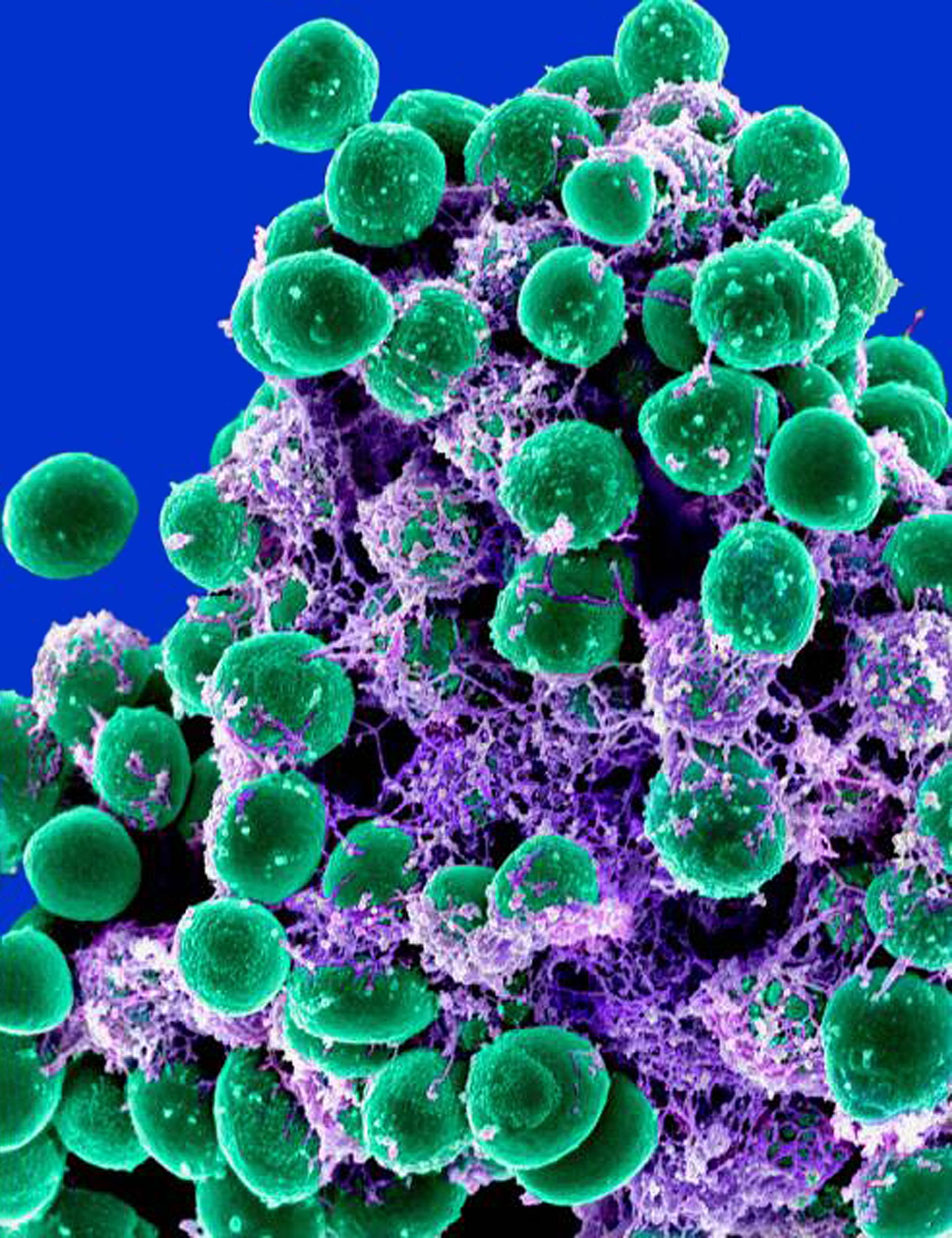 microscope image a clump of green-colored, spheroid shaped bacteria, that are enmeshed in a purple-colored, filamentous extracellular matrix, on a bright blue background.