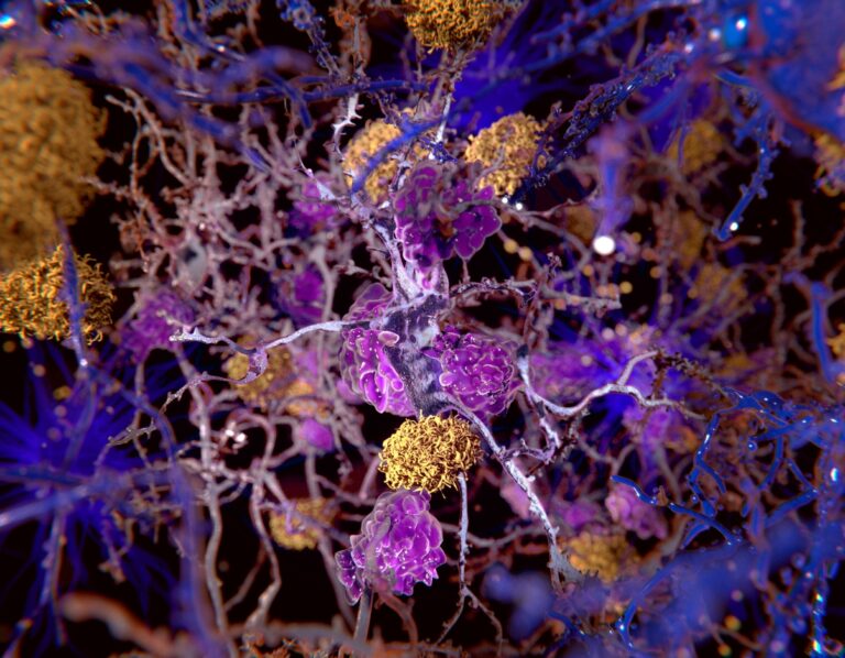3D illustration of yellow clumps amongst blue and purple cells and molecules
