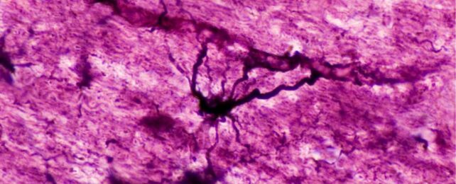 Psychedelics May 'Reset' Brain Cells in Mood And Immune Disorders