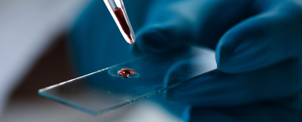 This Blood Signal Could Warn You of Alzheimer's 10 Years Before Symptoms