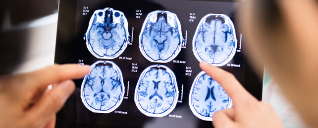 Brain scans