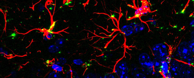 Brain cell scans