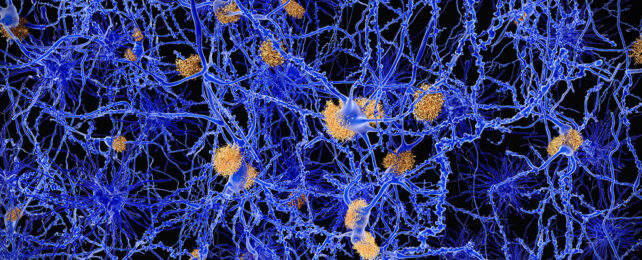 Alzheimer's disease