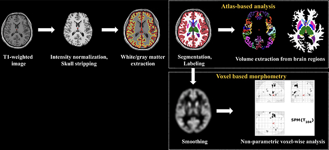 Brain scans