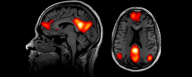 Brain Scans