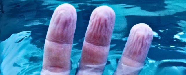 Mystery About The Way Fingers Wrinkle in Water Might Have an Answer