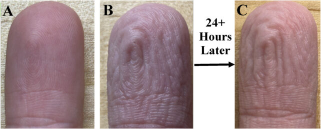 An image of a smooth finger tip and then two similar water wrinkled fingers