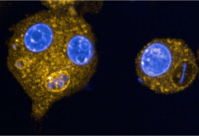 Macrophages infected by Yersinia pestis bacteria, shown as big yellow blobs with blue eye-like spots