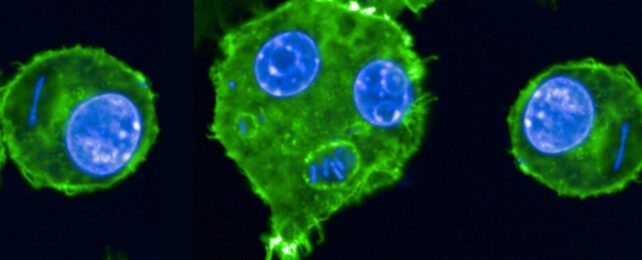 Macrophages in bright green, infected with blue Yersinia pestis bacteria