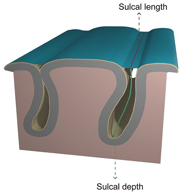 Sulcal depth diagram