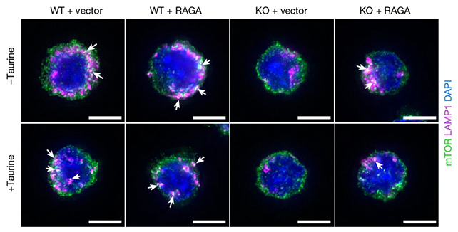 Cancer cells analysis