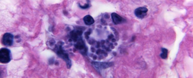 Toxoplasma Cyst