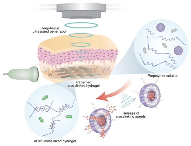 Scientists 3D Print Hydrogel Bandages And ECG Monitors Directly Inside The Body