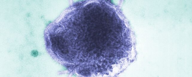 measles virus particle