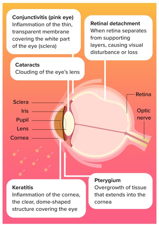 risks to vision diagram