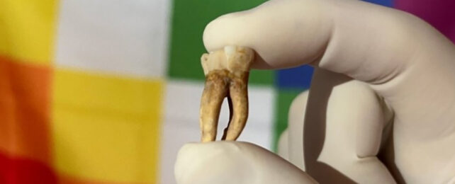 Ancient tooth