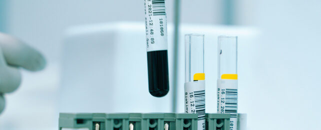 Blood test sample