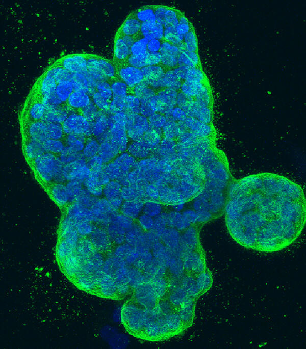Rounded clumps outlined in green with blue clusters withing.