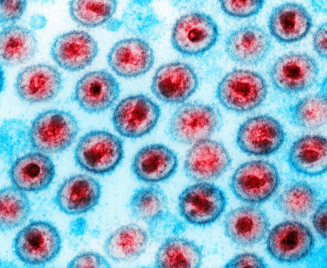 FDA Approves Injection to Prevent HIV Transmission