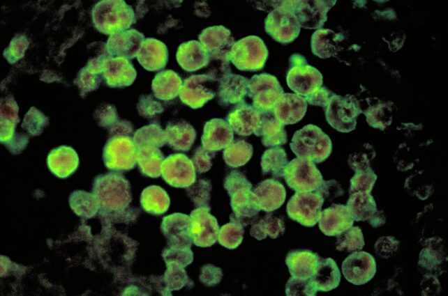 US Woman Dies From Brain-Eating Amoeba After Flushing Sinuses With RV Water