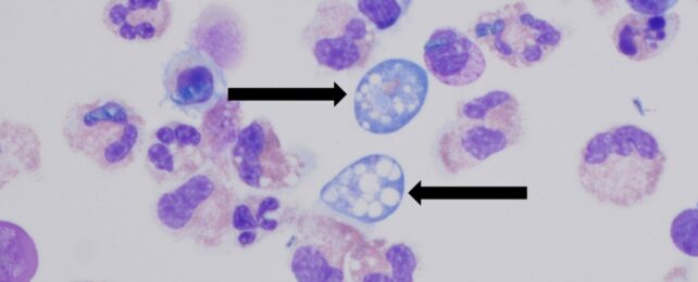 Microscope image of ameoeba
