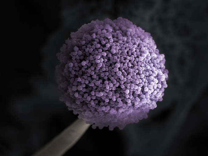 Fruiting body of the fungus Aspergillus niger under microscope colored purple