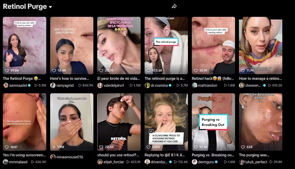 screenshot of tiktok search results for retinol purge, with many different thumbnails of videos addressing the topic