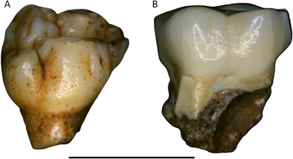 close up photos of two different teeth.