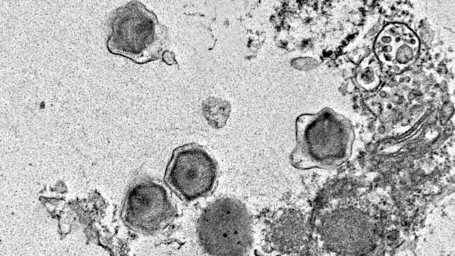 230 New Giant Viruses Found Lurking in The Ocean, Hijacking Their Hosts