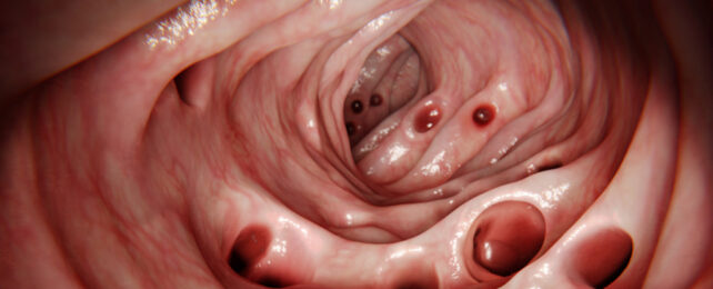 gut illustration