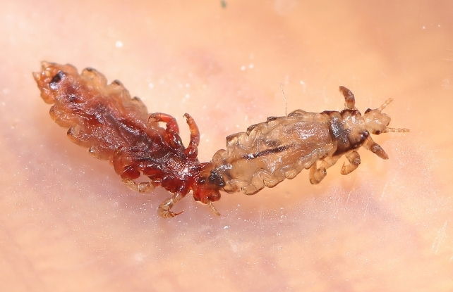 head lice