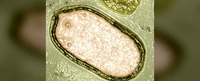 pandoravirus