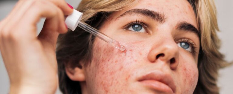 Does Retinol Reverse Signs Of Aging Here S The Science Sciencealert