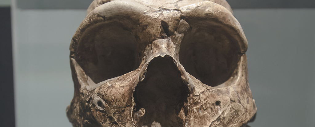 Brain Abnormality in Modern Humans Linked to Ancient Neanderthal DNA : ScienceAlert