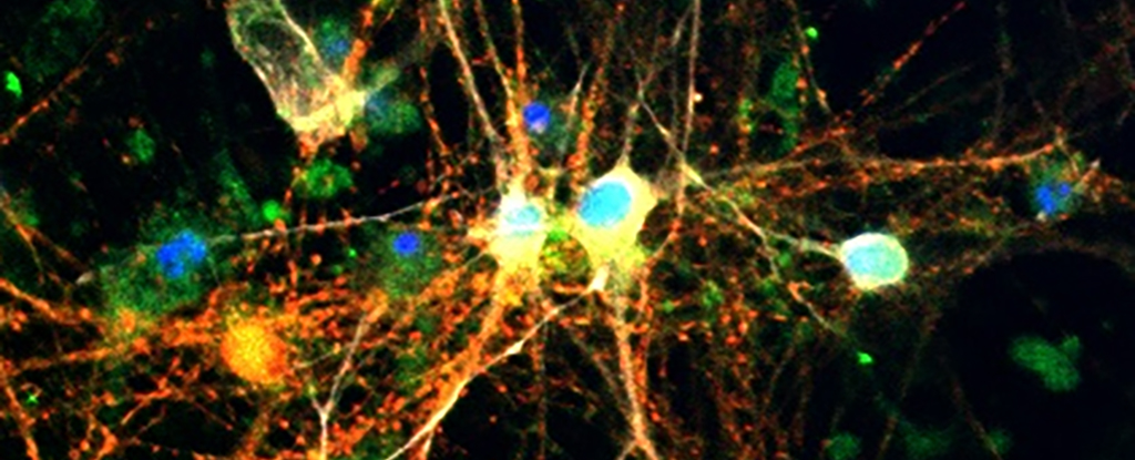 www.sciencealert.com image