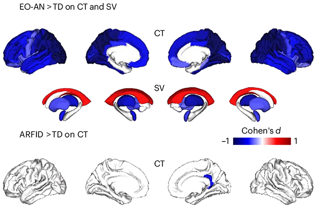 Brain disorder scans