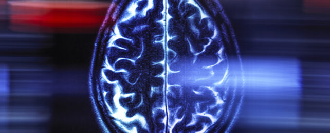 Brain scan