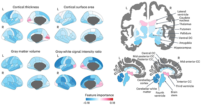 Brain scan differences