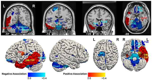 Brain structure scans