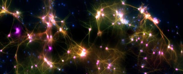 Neurons on black background