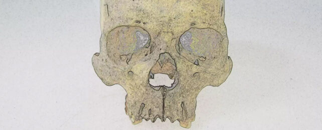 Human skull