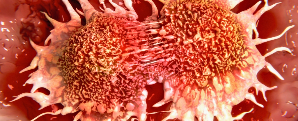 Common Viruses May Wake Dormant Breast Cancer Cells, Study Finds : ScienceAlert
