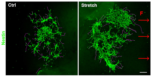 Guided Nanoparticles Reconnect Mind Cells, Elevating Hopes For Parkinson’s Remedy