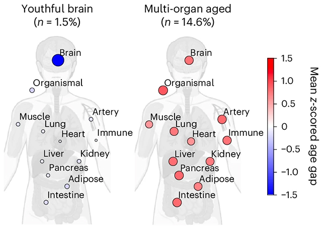 Your Mind’s Youthfulness (or Loss of It) May just Are expecting How Lengthy You Reside