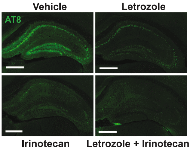 Scientists In finding 2 Current Medicine Can Opposite Alzheimer’s Mind Injury in Mice