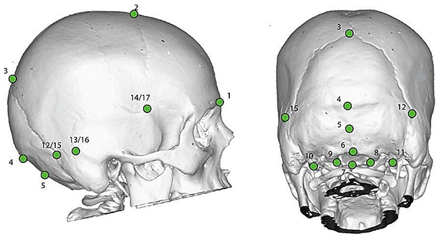 Skull analysis diagram