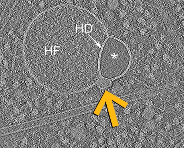 Mysterious New Construction Found out Hiding Within Human Cells