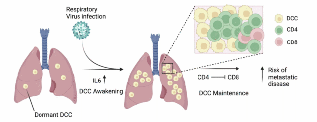 Dormant Breast Cancer Cells