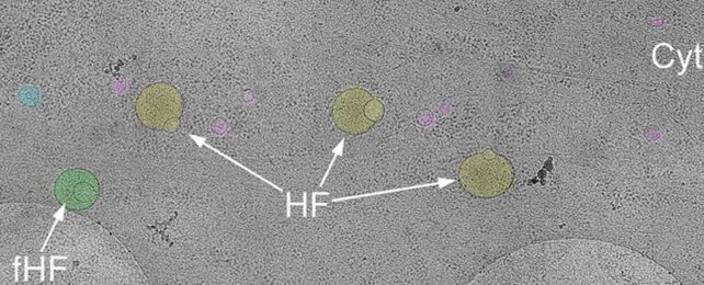 Mysterious New Structure Discovered Hiding Inside Human Cells